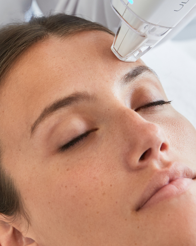 Utilisation du LaseMD Ultra pour améliorer l'éclat du teint et atténuer les taches pigmentaires grâce à un peeling doux au laser